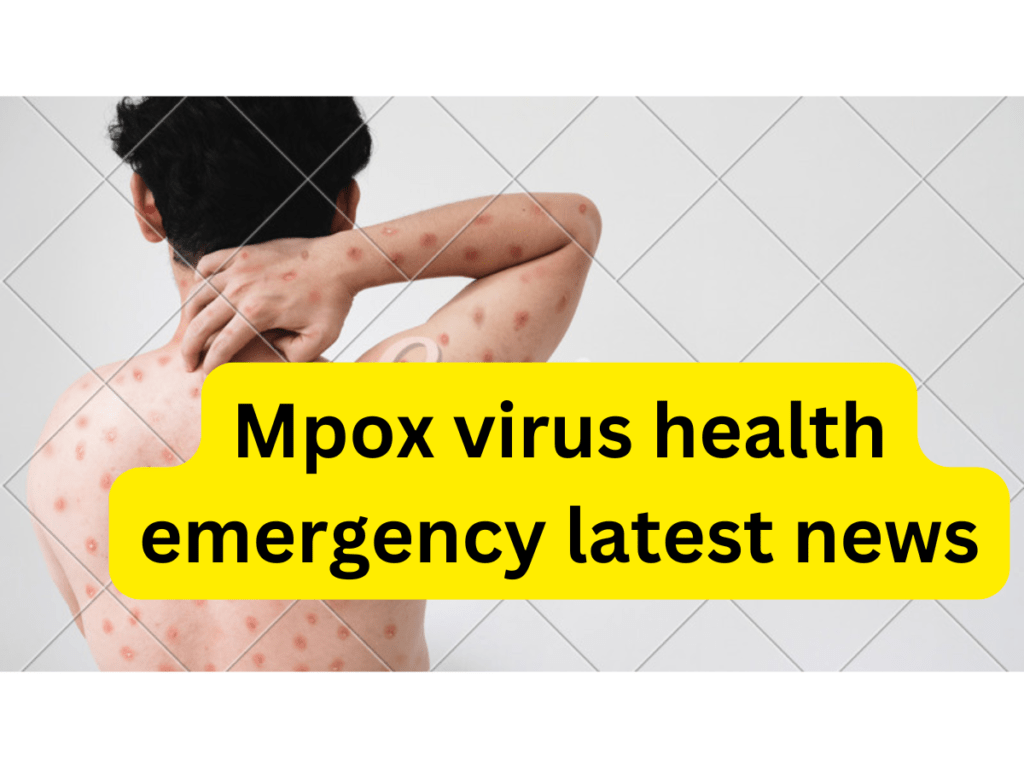 mpox virus health emergency